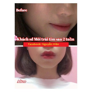 Tinh Chất Thon Gọn Môi Miracle