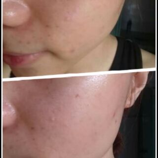 Mỡ trăn nguyên chất 100ml.