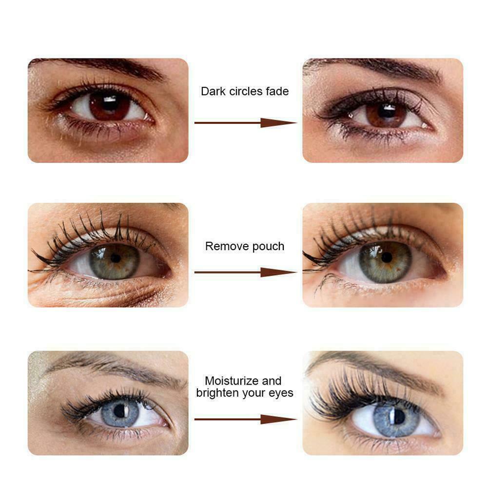 (Hàng Mới Về) Kem Dưỡng Da Mắt 30g Q6J8 Chiết Xuất Peptide / Peptide / Rắn Giúp Nâng Cơ Và Làm Săn Chắc Vùng Da Quanh Mắt