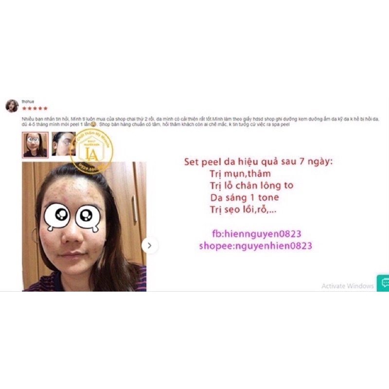 Thay Da Sinh Học Peel TCA Zenus
