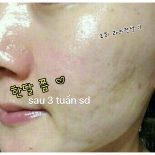 Combo 50 gói Tinh Chất Vàng OHUI The First