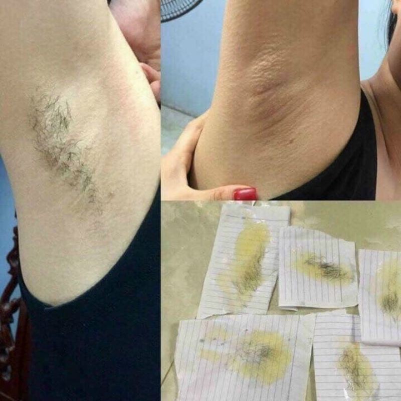 WAX lạnh tẩy lông HORSHION | BigBuy360 - bigbuy360.vn