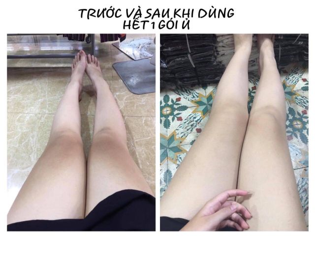 Ủ TRẮNG CAFE CHÍNH HÃNG | BigBuy360 - bigbuy360.vn
