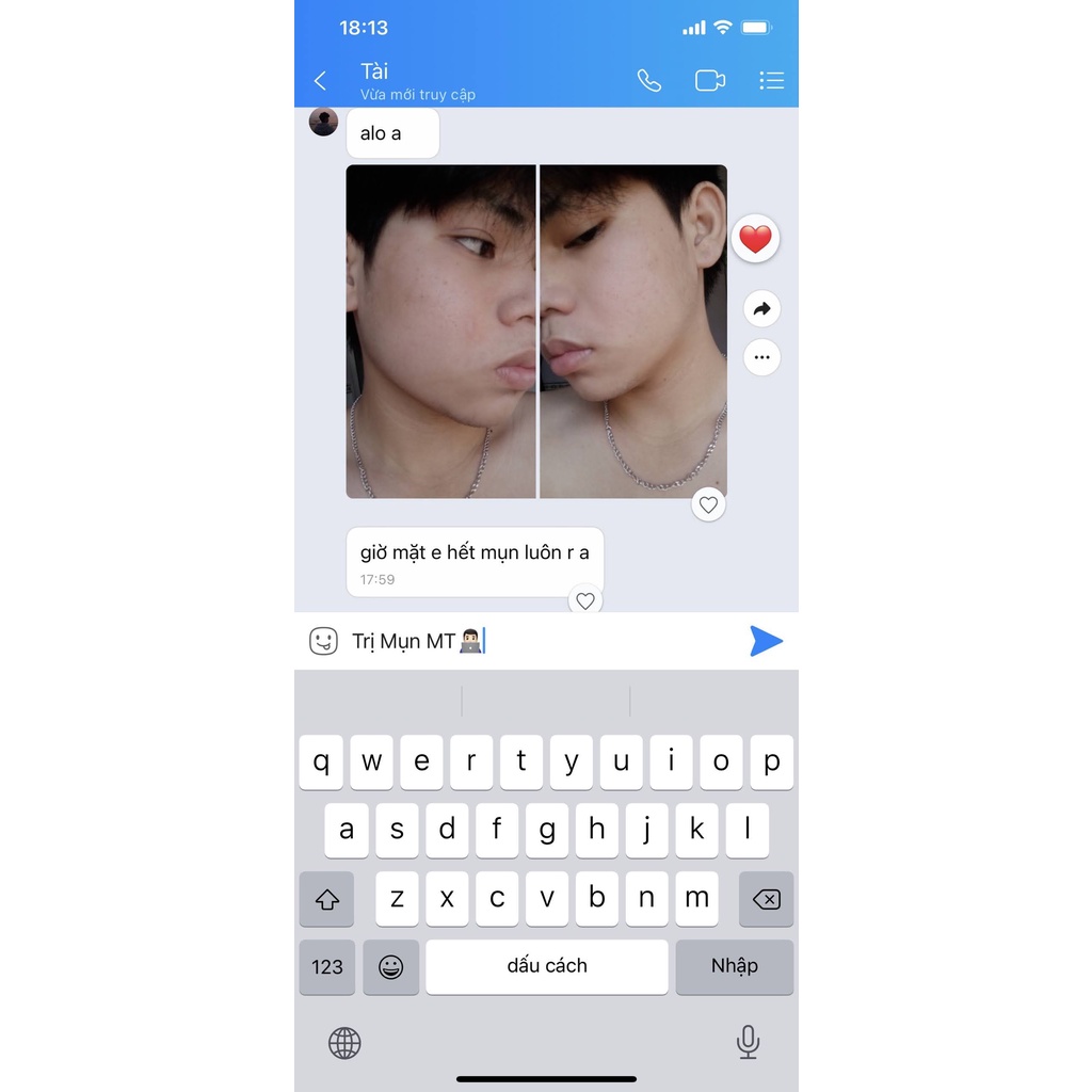 Thảo Dược Giảm Mụn Thâm Rỗ MT | BigBuy360 - bigbuy360.vn