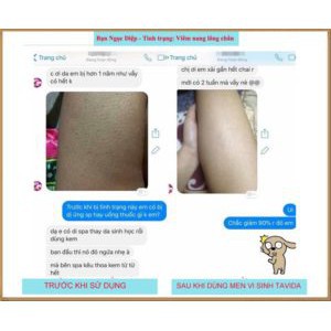 MEN VI SINH TAVIDA HẾT MỤN LƯNG, VIÊM NANG LÔNG, MẨN NGỨA | BigBuy360 - bigbuy360.vn