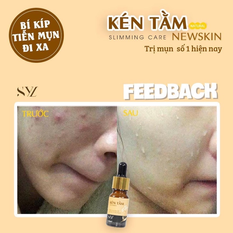 Kén tằm Newskin tái tạo da và phục hồi da mụn (10ml)