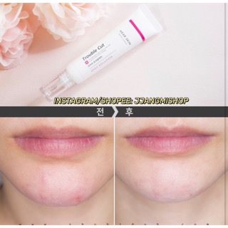Gel đặc trị mụn và làm mờ vết thâm - Missha Near Skin Trouble Cut Spot Solution 20ml