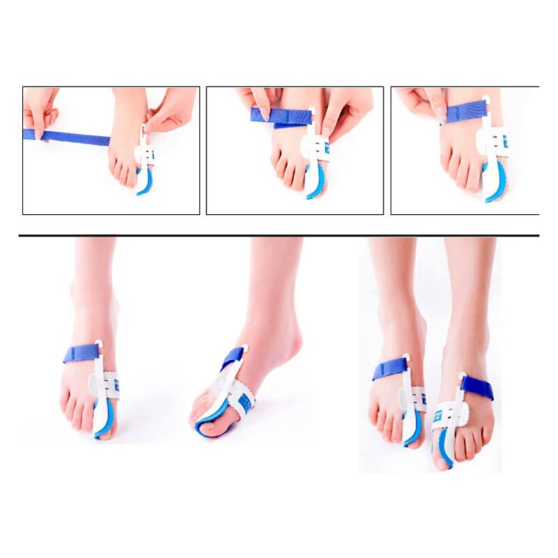 Dụng cụ nẹp định hình ngón chân cái