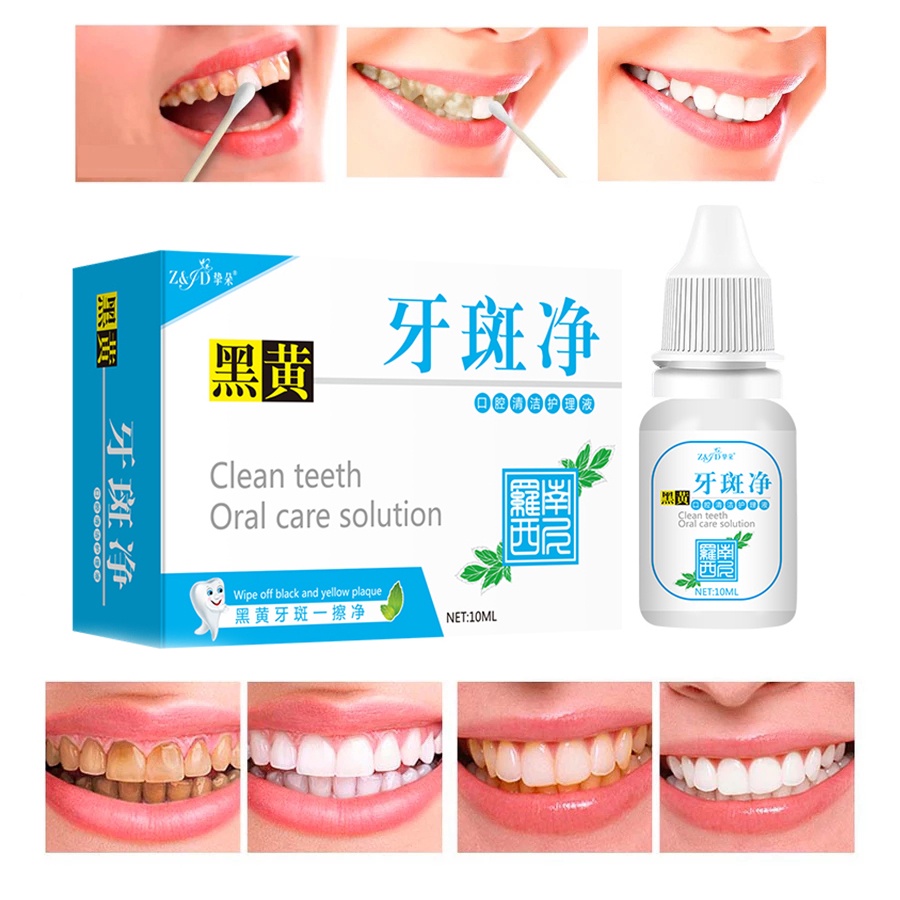Tinh Chất Làm Trắng Răng Loại Bỏ Vết Ố Trên Răng Tiện Dụng