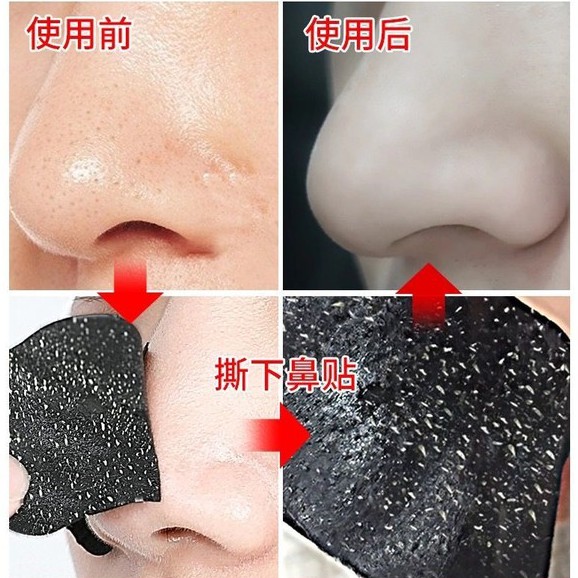 Mặt Nạ Lột Mụn Đầu Đen Vùng Mũi Hiệu REAL STYLE