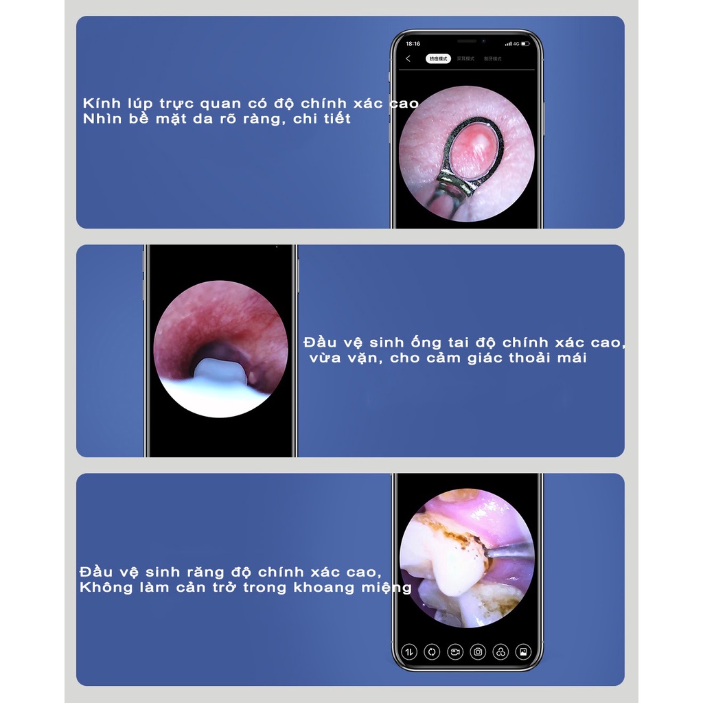 Bộ vệ sinh đa năng tích hợp camera Sunuo FIND X