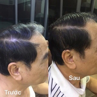 Dầu gội thảo dược đen tóc TOSMEDY ( NÂU, ĐEN )