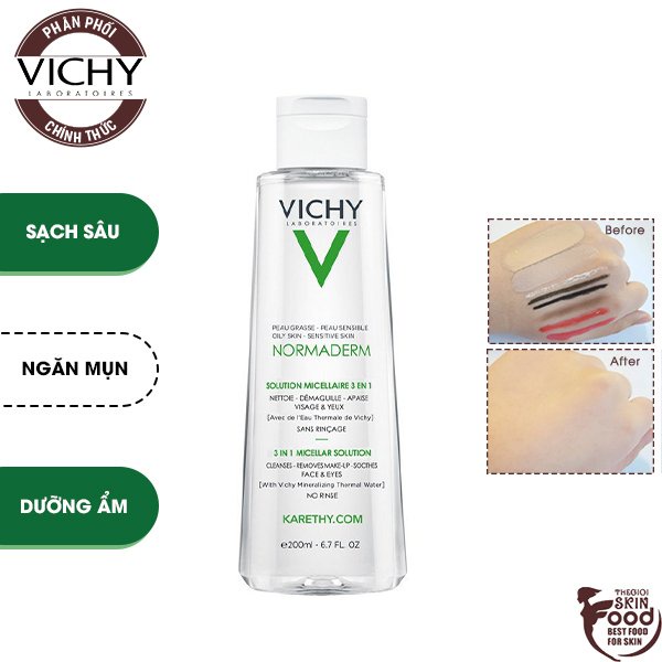 Nước Tẩy Trang Dành Cho Da Dầu Mụn Vichy Normaderm 3-in-1 Micellar Solution 200ml