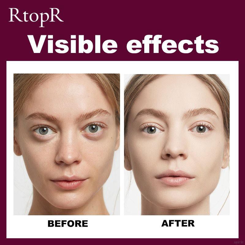 (Hàng Mới Về) Gel Tẩy Tế Bào Chết Da Mặt Chiết Xuất Xoài Rtopr Làm Sạch Sâu Và Se Khít Lỗ Chân Lông | BigBuy360 - bigbuy360.vn