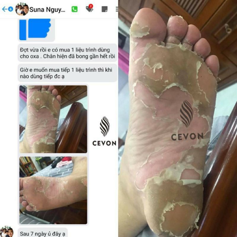 Mặt Nạ Ủ Da Chết Bàn Chân Foot Peel CEVON HÀN QUỐC,Hoa Hậu KỲ DUYÊN làm Đại Sứ