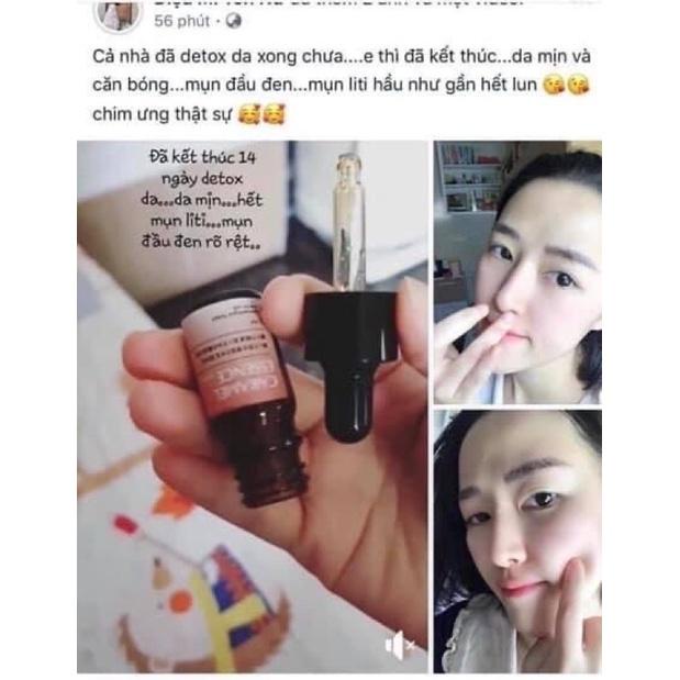 Serum CARAMEL ESSENCE Nhật Bản 5ml chính hãng, ngừa mụn xoá thâm dưỡng da mịn màng căng bóng