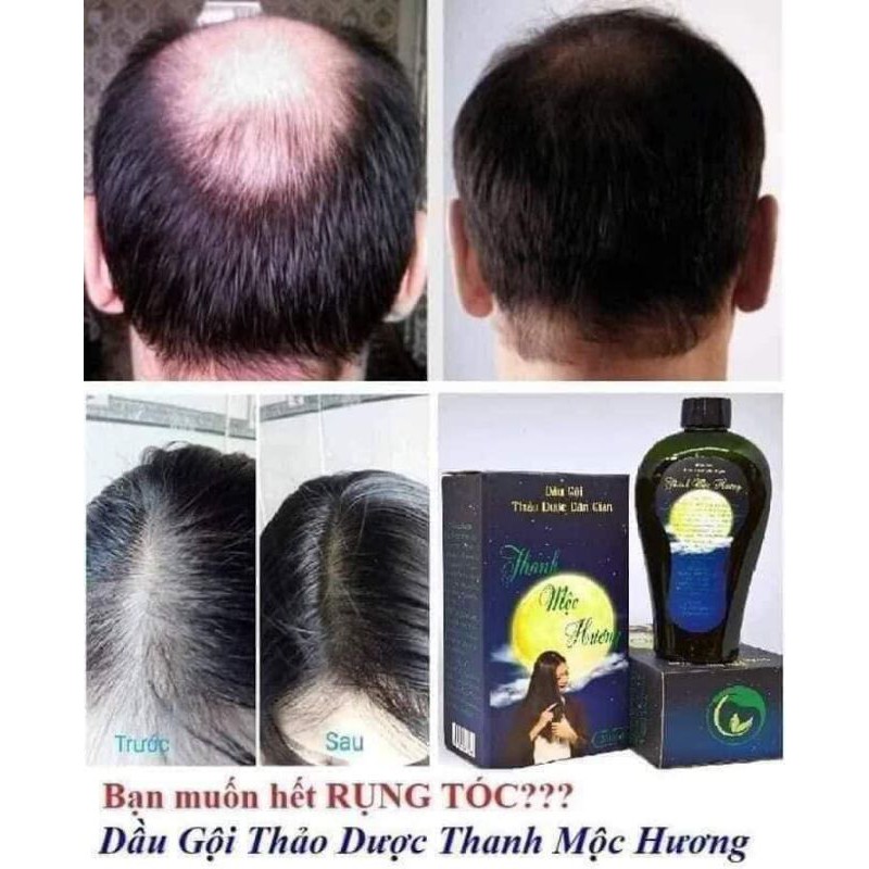 Dầu gội thảo dược rụng tóc, nấm da đầu Thanh_Mộc_Hương _ cam kết chuẩn công ty | BigBuy360 - bigbuy360.vn