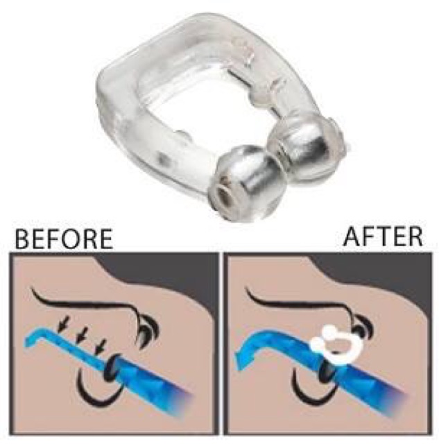 Dụng cụ giảm tiếng ngáy khi ngủ Noseclip