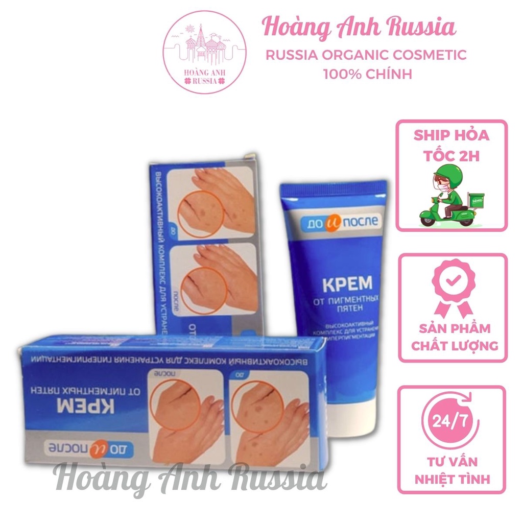 Kem tay đồi mồi Kpem