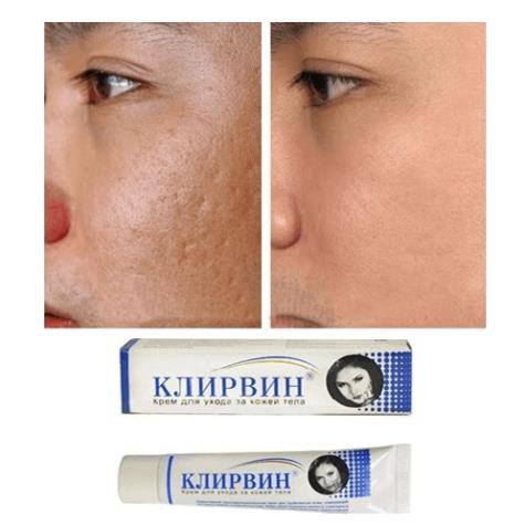 Kem Hỗ Trợ Trị Sẹo Klirvin Chính Hãng Của Nga | BigBuy360 - bigbuy360.vn