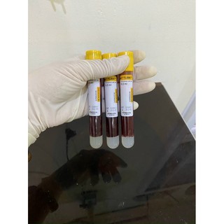 100 ống nghiệm chân không chống đông 8ml hàn quốc acd prp