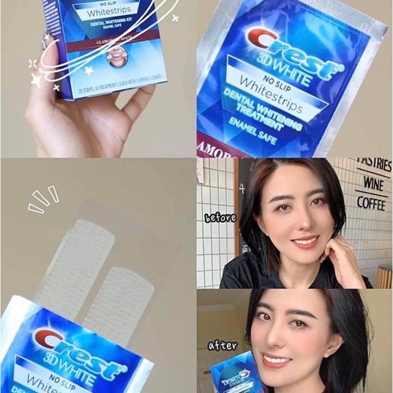 [FREE SHIP] Miếng Dán Trắng Răng 3D Crest Xịn