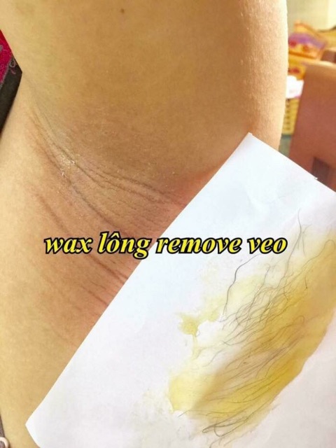 BỘ TRIỆT LÔNG VEO REMOVE - CÔNG TY NGÂN BÌNH - (có tặng kèm giấy wax và que lấy)