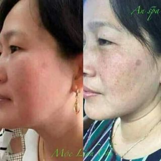 Thảo dược Mộc Linh Chi