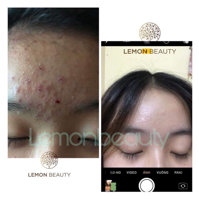 [MUA 1 TẶNG 4] - LEMON MASK KHỔ QUA RỪNG | BigBuy360 - bigbuy360.vn