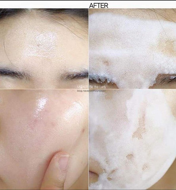 MASK SUM SỦI BỌT THẢI ĐỘC GIẢM MỤN