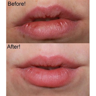 Tẩy Da Chết Môi Smooth Lip Scrub