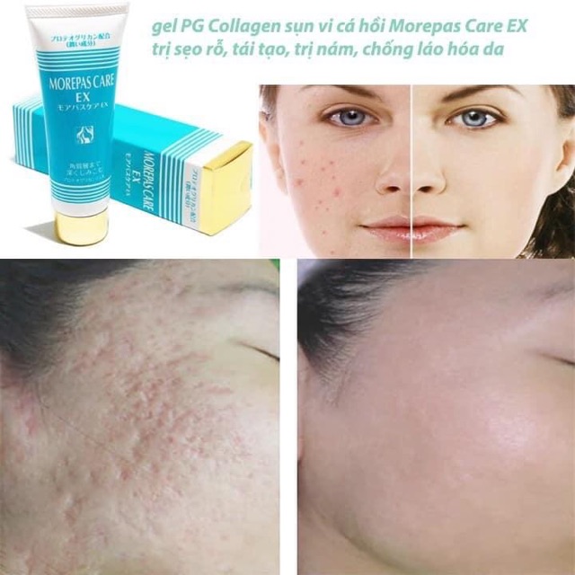 (MiNi) Kem PG Collagen sụn cá Morepas Care Ex Chuẩn Nhật Bản