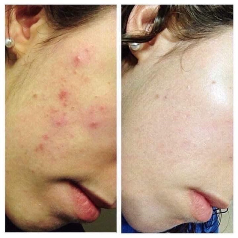 [CHÍNH HÃNG] Sữa Rửa Mặt CeraVe Foam Cleanser 473ml