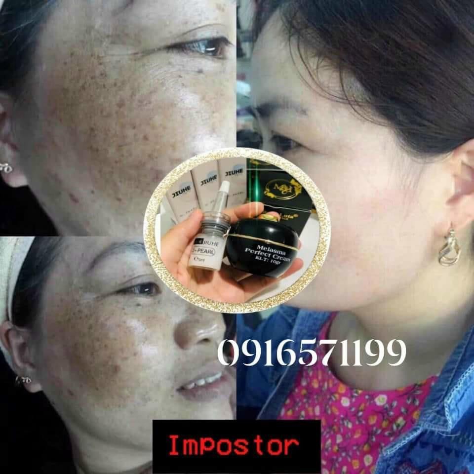 COMBO serum jiuhe Thanh Tô + kem cao nám Balla Luta (chính hãng 100%)