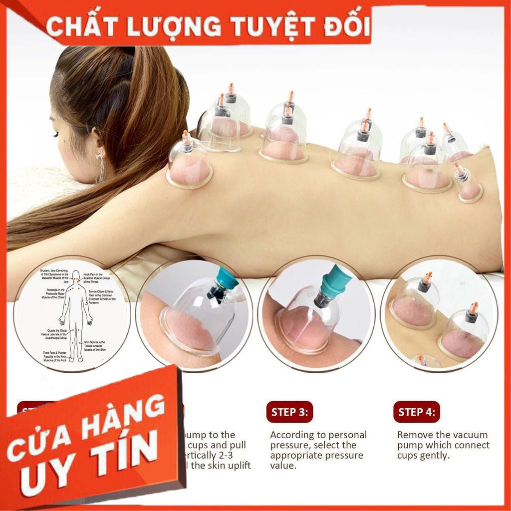 [XẢ KHO+FREE SHIP]  Bộ giác hơi 12 món không dùng lửa