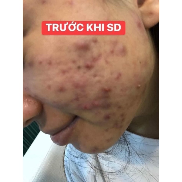 COMBO 2 cốt nhân sâm