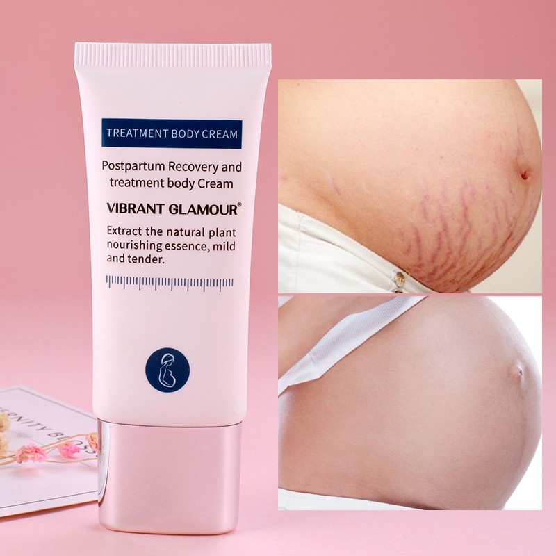 [Hàng mới về] Kem VIBRANT GLAMOUR chống lão hóa làm săn chắc mịn màng/ làm trắng da 30g | BigBuy360 - bigbuy360.vn