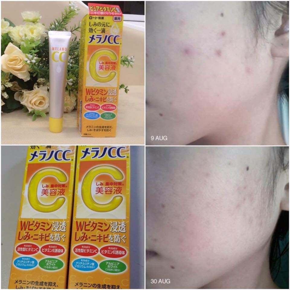 Serum Trắng Da CC Melano 20ml Nhật Bản,Tinh chất dưỡng da Vitamin C Melano CC Rohto