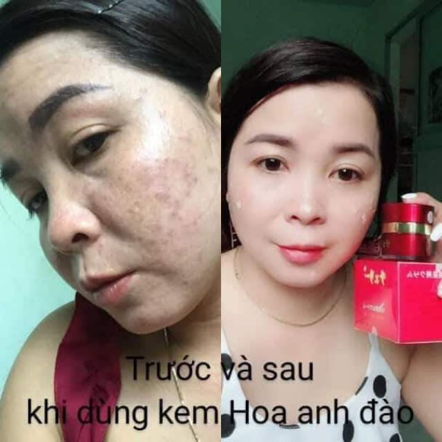 Kem Face Dưỡng Trắng Da Hoa Anh Đào