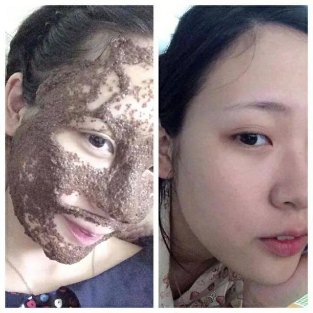 [ Chất Lượng Loại 1 ]Ngũ hoa 1kg chuyên dùng spa thẫm mỹ viện hạt bé