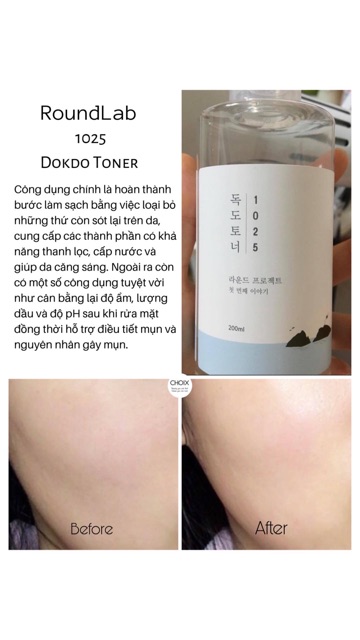 TONER ROUNDLAB DƯỠNG ẨM LÀNH TÍNH 200ML