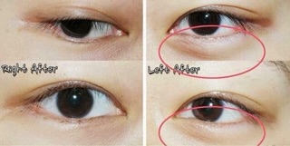 Mặt nạ mắt JM SOLUTION EYE PATCH