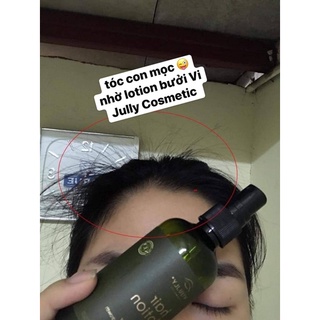 COMBO 5 Chai Tinh Dầu Bưởi Vi Jully