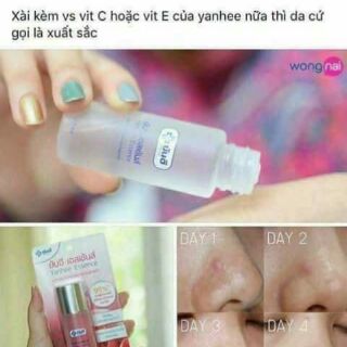 Nước hoa hồng yanhee Esence
