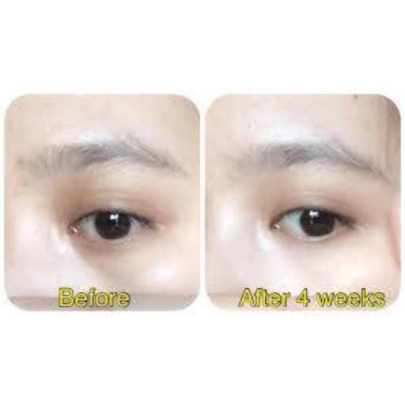 Kem thâm làm sáng da vùng mắt MEISHOKU WHITENING EYES CREAM 30g [NỘI ĐỊA NHẬT] | BigBuy360 - bigbuy360.vn