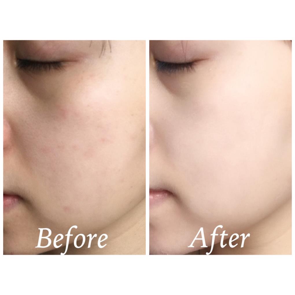 Kem ZO Skin Health Pigment Control + Blending Creme 4% HQ