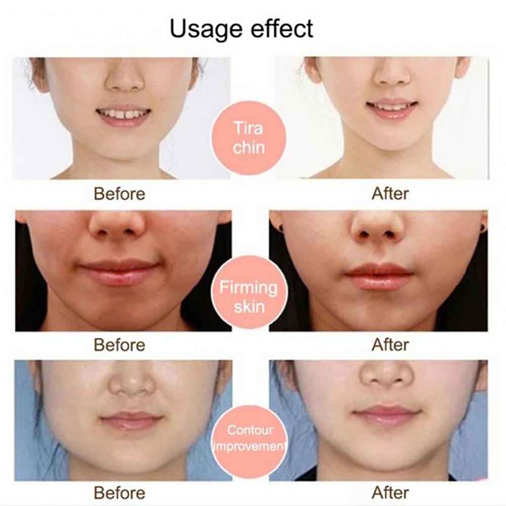 Đai đeo mát xa làm thon gọn mặt tạo cằm chữ v chống nếp nhăn hiệu quả