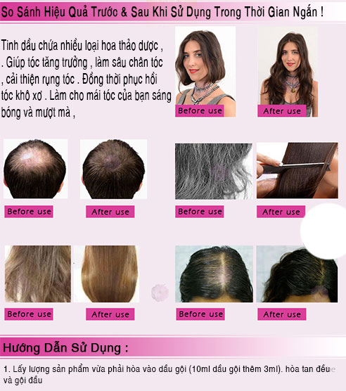 RtopR Dầu Tăng Trưởng Tóc Nhỏ Kích Mọc Tóc Nhanh Chóng & Chăm Sóc Bảo Vệ Cho Tóc Chai 20ml