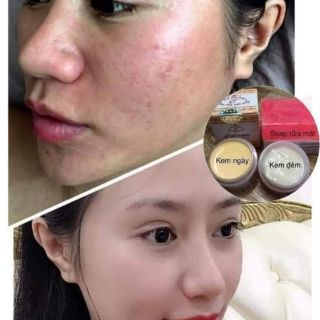Kem collagen plus vit e chính hãng