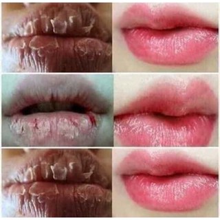 Son sáp dưỡng môi Laco - Siêu mềm môi, căng mọng